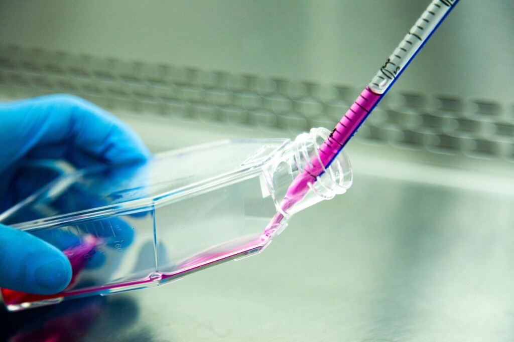 Badanie HPV DNA jak wygląda w praktyce?